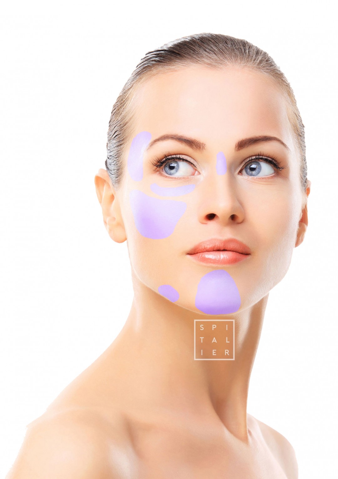 hyaluronic acid injection Docteur Spitalier